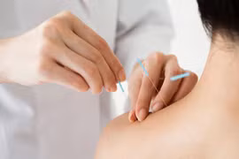 Đắp lá vào vùng châm cứu dễ bị nhiễm trùng máu