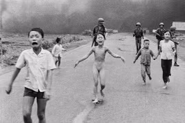 Hành trình chữa bỏng đau đớn của “em bé Napalm” Kim Phúc