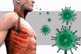 Gallery - Đại dịch Ebola - image 6