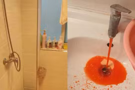 Người đàn ông sợ khiếp vía khi vòi nước chảy ra máu