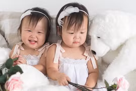 Hành trình trở thành ngôi sao của cặp song sinh tưởng chừng không thể sống
