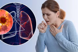 84% số ca tử vong tại Việt Nam do bệnh không lây nhiễm