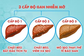 Địa chỉ vàng: Thực phẩm chức năng hỗ trợ gan nhiễm mỡ