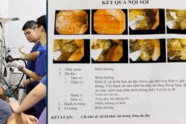 Ăn quả ngõa, người đàn ông 37 tuổi bị bã thức ăn nút dạ dày