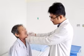 Phải cắt bỏ lưỡi vì vết loét nhỏ, chuyên gia cảnh báo điều cần lưu ý