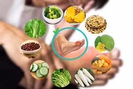 Cách ăn then chốt trong điều trị bệnh gút