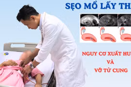 Thai bám ở sẹo mổ lấy thai, nguy cơ xuất huyết và vỡ tử cung