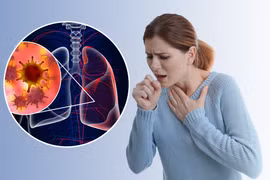 Bác sĩ mách cách tránh ho, đau họng khi thời tiết giao mùa