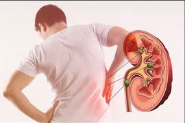 Cách nhận biết dấu hiệu suy thận để kịp thời xử lý