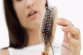 Bác sĩ mách cách thay đổi thói quen, cách ăn uống để tránh rụng tóc