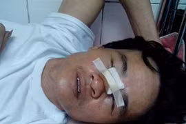 Công an bị tố vô cớ bắn người trọng thương 