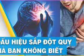 Dấu hiệu cảnh báo có thể sắp bị đột quỵ không phải ai cũng biết