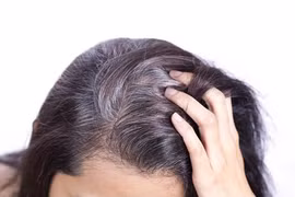 Ăn gì ngăn tóc bạc sớm?