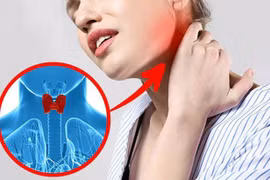 Những dấu hiệu cảnh báo bệnh lý tuyến giáp không được chủ quan