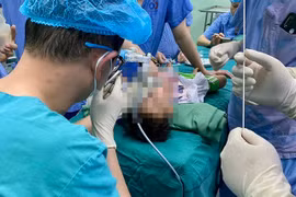 Bé trai 34 tháng tuổi viêm phổi do vỏ hướng dương rơi vào khí quản