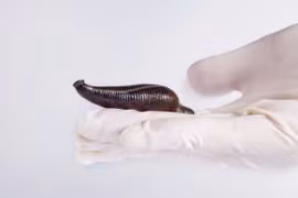 Từ vụ đỉa 10 cm chui vào... cụ ông: Biểu hiện đỉa xâm nhập cơ thể