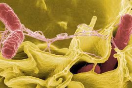 Vi khuẩn Salmonella và E.coli nguy hiểm thế nào?