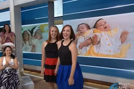 Gallery - Phẫu thuật tách cặp song sinh dính liền - image 8