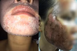 Gallery - Mỹ Phẩm Độc Hại - image 8