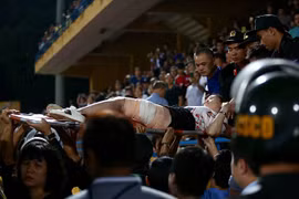 Gallery - Fan nữ trúng pháo sáng CĐV Nam Định - image 8