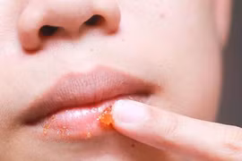 Mẹo giúp môi không bị nhiễm chì khi đánh son