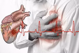 Không muốn chết sớm, cần biết nguyên nhân khiến tim ngừng đập