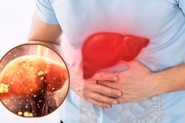 5 thói quen tàn phá gan vào mùa lạnh