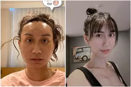 Gallery - Lynk Lee chuyển giới - image 2
