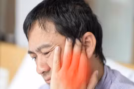 Liệt dây thần kinh số 7 có thể chữa khỏi không, cách phòng tránh?