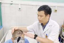 Người đàn ông 63 tuổi đóng đinh 5 cm vào đầu vì trầm cảm