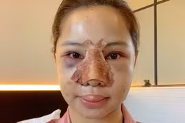 Gallery - Lưu Đê Ly ẩu đả với antifan  - image 7