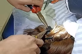 Kẹp tóc kiểu này, người phụ nữ suýt mất mạng