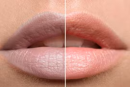 Môi nhợt nhạt thiếu chất gì?