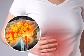5 loại lá thảo dược là “khắc tinh” của gan nhiễm mỡ
