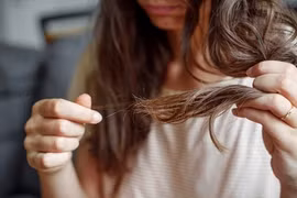 Rụng tóc bất thường, có thể dấu hiệu cảnh báo một số bệnh lý