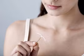 Bác sĩ chỉ rõ thời điểm phù hợp để đặt vòng tránh thai