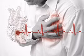 Bác sĩ chỉ cách phát hiện suy tim cấp kịp thời