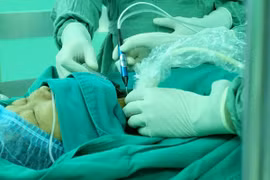 Khi nào thì nên mổ bướu cổ?