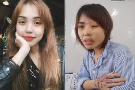 Gallery - Cựu thiếu úy công an tạt axit vợ sắp cưới - image 2