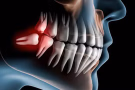 Vì sao răng người tiền sử lại thẳng và đều đến vậy?