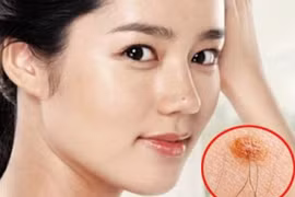 4 vị trí đột nhiên mọc lông gia chủ ngồi không hưởng lộc