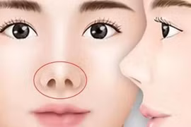 6 nét tướng của người hay gặp xui xẻo, làm ra tiền khó giữ