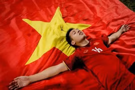 Gallery - ĐỖ HÙNG DŨNG BỊ GÃY GẬP CHÂN - image 1