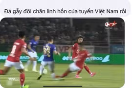 Gallery - ĐỖ HÙNG DŨNG BỊ GÃY GẬP CHÂN - image 2