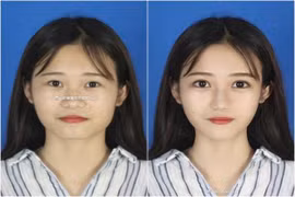 Trước và sau photoshop, nhan sắc hội chị em được "nâng tầm" ra sao?