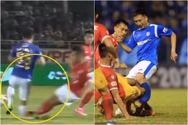 Gallery - ĐỖ HÙNG DŨNG BỊ GÃY GẬP CHÂN - image 3