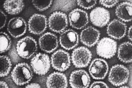 Virus herpes simplex (HSV-1) gây bệnh mụn rộp hoặc zona thần kinh ở người.