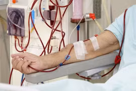 Suýt mất mạng vì... bỏ chạy thận định kỳ