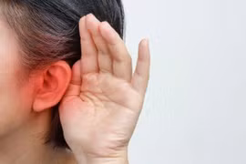 Đột ngột ù tai, dịch đục chảy ra, đi khám mắc lồi xương ống tai ngoài