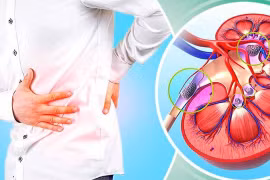 8 dấu hiệu sớm cho thấy thận của bạn không hoạt động bình thường